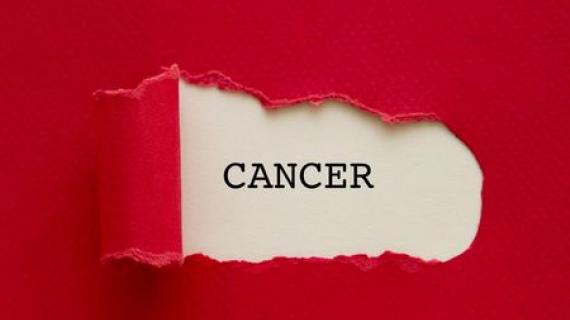 Types of cancer, Symptoms of cancer, Preventive Methods of Cancer, Know About cancer, Cancer.